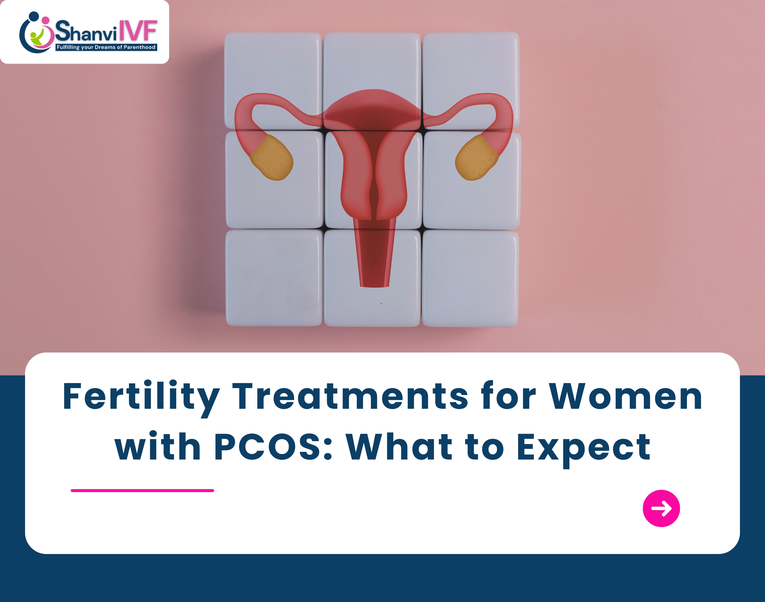 Fertility Treatments for Women with PCOS: What to Expect