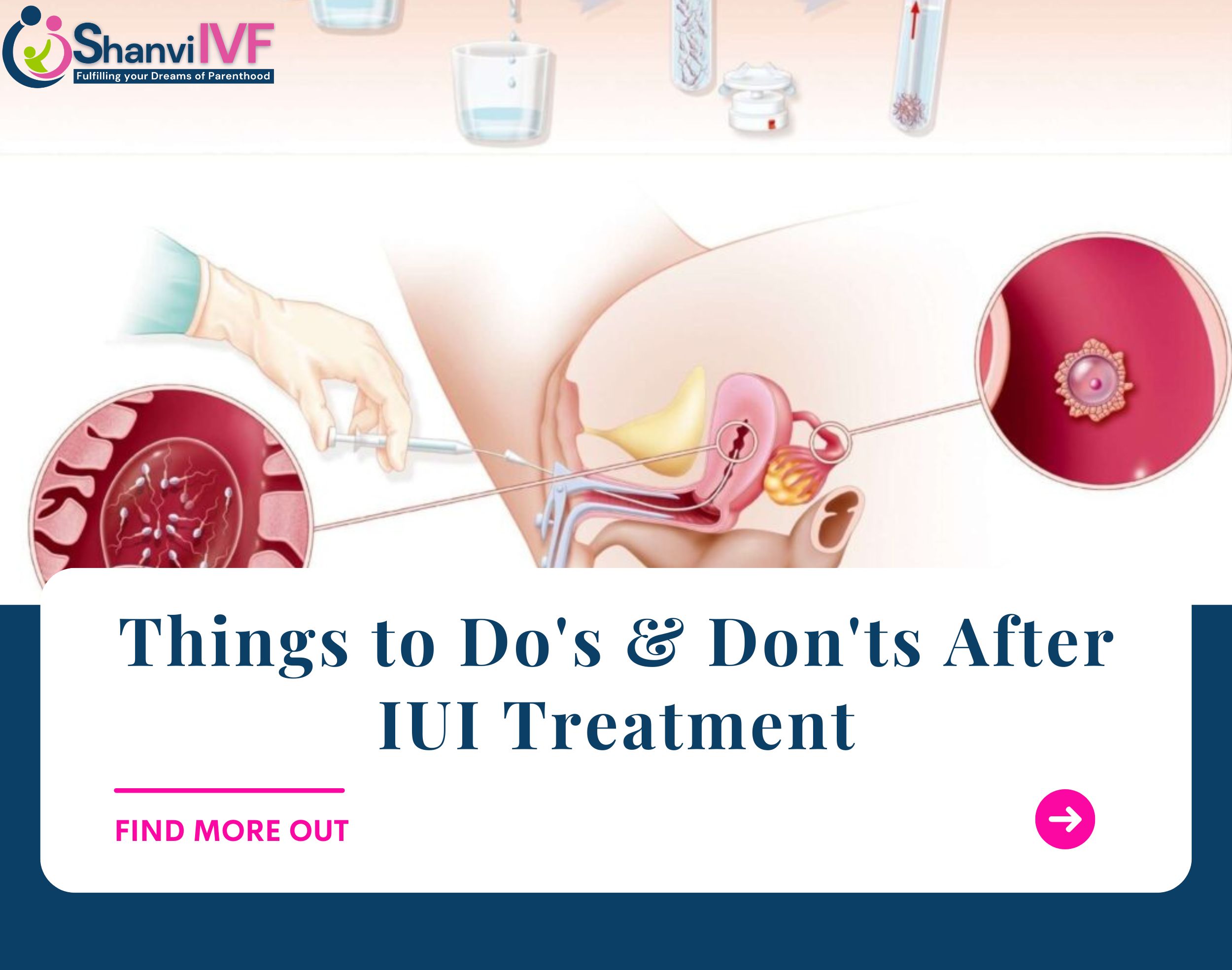 Things to Do’s & Don’ts After IUI Treatment