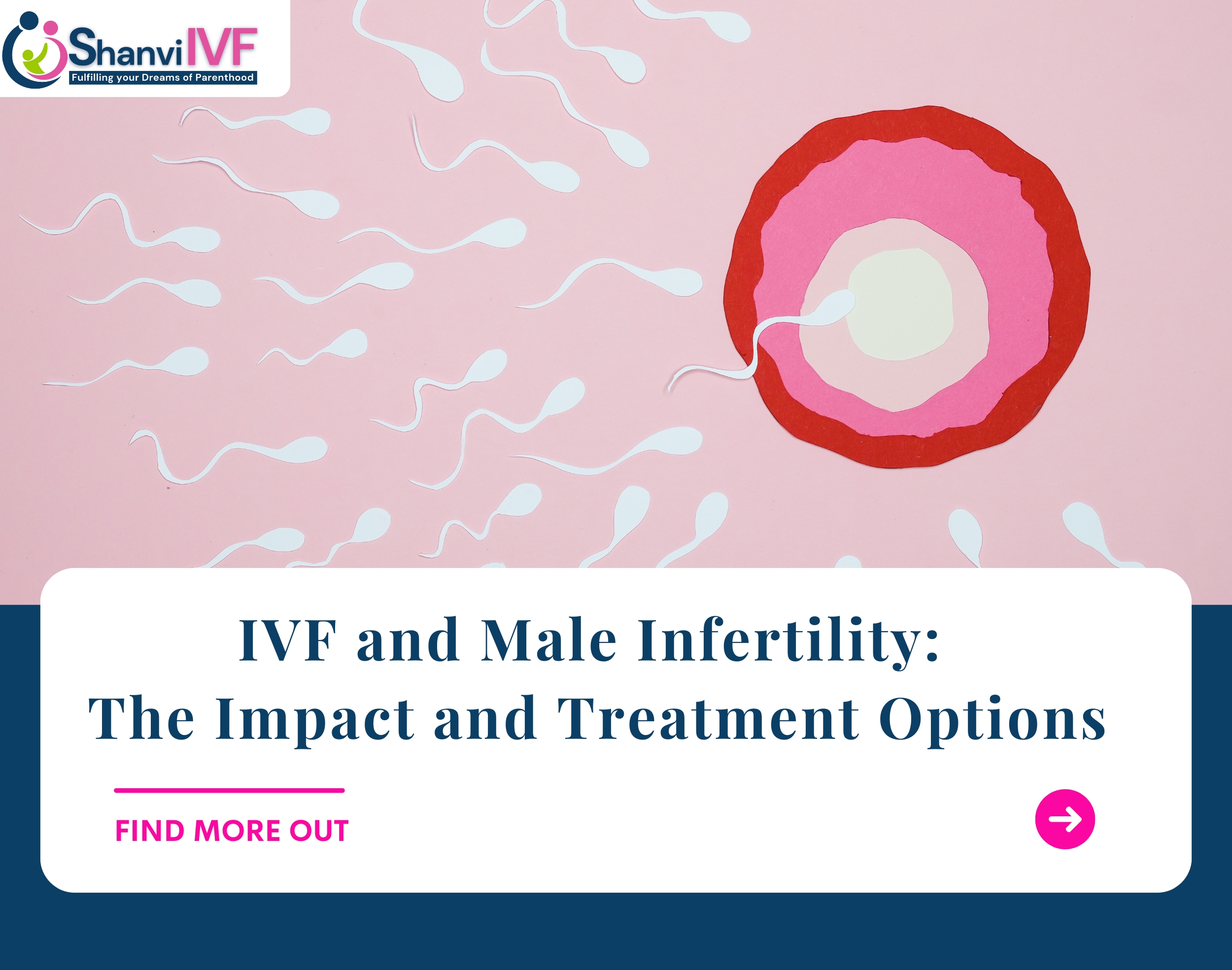 IVF and Male Infertility: The Impact and Treatment Options