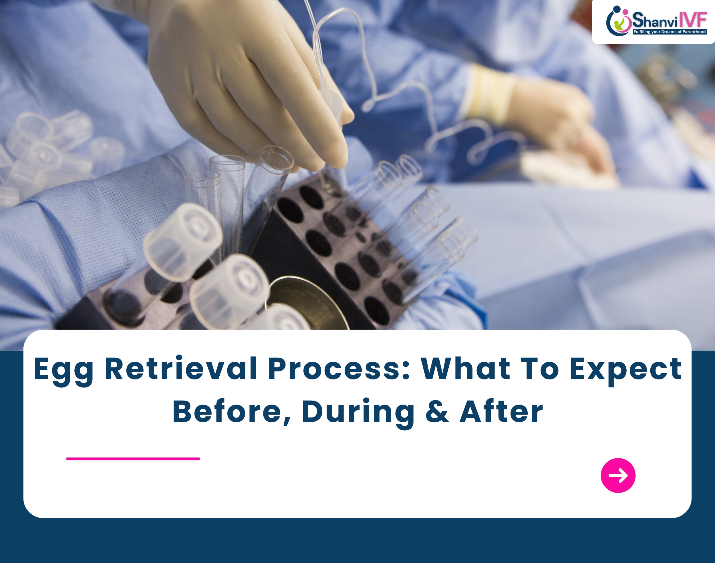 Egg Retrieval Process: What to Expect Before, During, & After