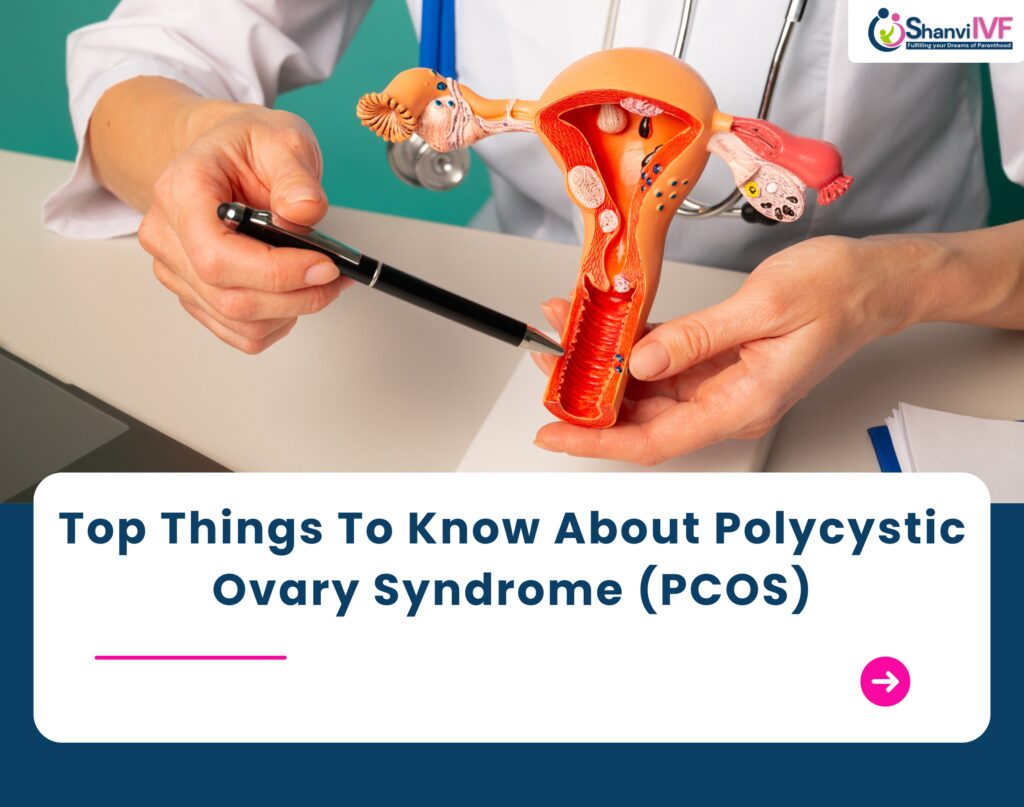 Top Things To Know About Polycystic Ovary Syndrome (PCOS)