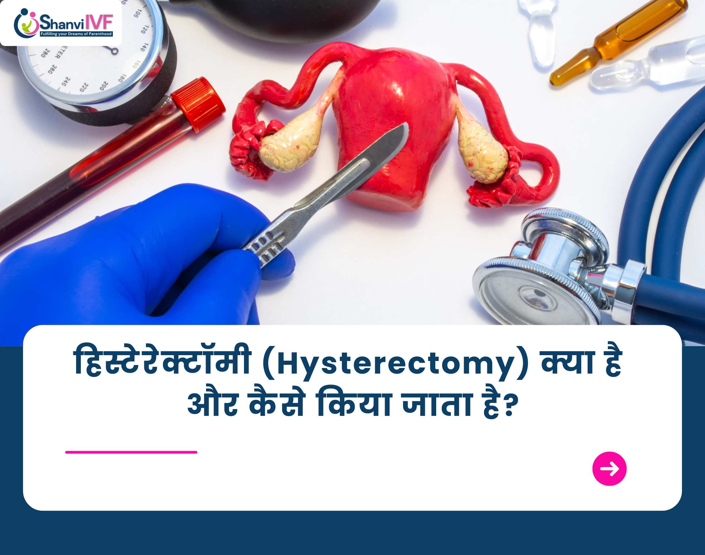what is Hysterectomy