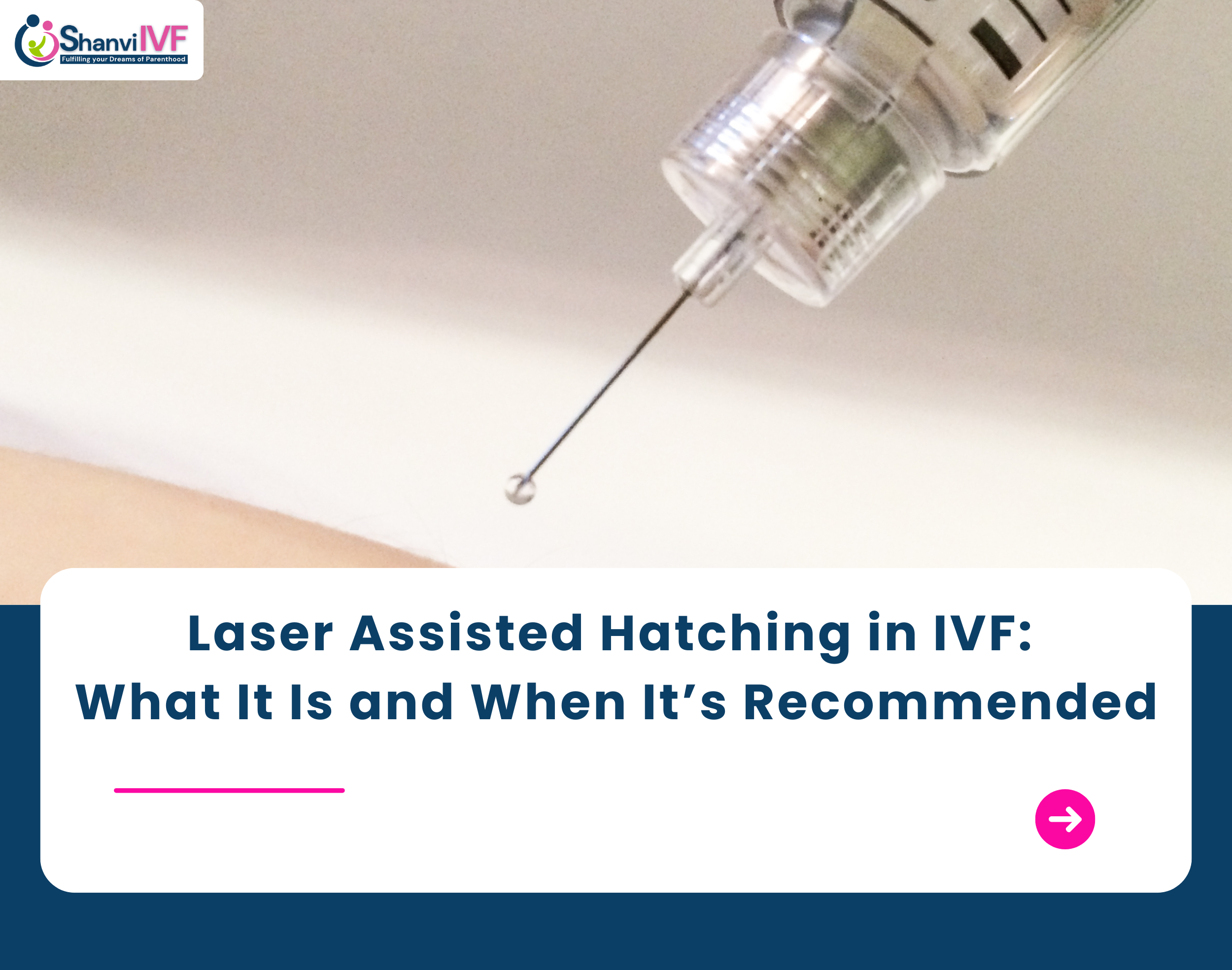 Laser assisted Hatching in IVF What It Is and When It’s Recommended